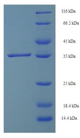 Human SMUG1 Protein (Recombinant His-SUMO)