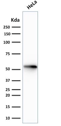 KRT7 / CK7 / Cytokeratin 7 Antibody (clone rOV-TL12/30, Azide-free, Carrier-free)