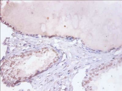 Polyclonal Rabbit anti-Human HNRNPD / AUF1 Antibody (IHC, WB)
