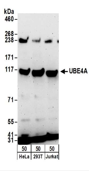 E4 / UBE4A Antibody (aa1016-1066)