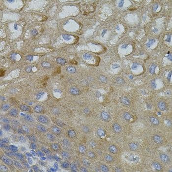Polyclonal Rabbit anti-Mouse Mitofusin 2 / MFN2 Antibody (IHC, WB)