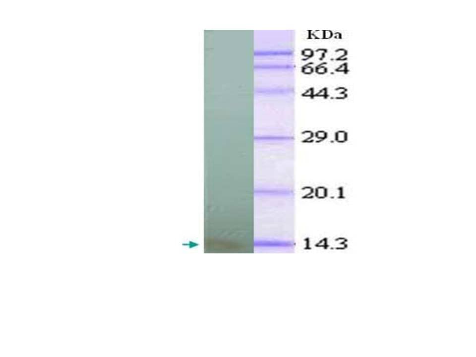 CXCL10 / IP-10 Antibody (clone 1)