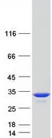 Human TPI1 / TPI Protein (Recombinant Myc-DDK (Flag))