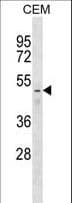 FNTB Antibody (aa12-40)