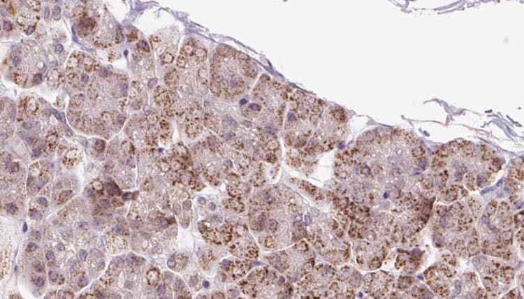Polyclonal Rabbit anti-Human FXR1 Antibody (IHC, IF, WB)