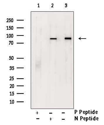 Polyclonal Rabbit anti-Human NTRK1 / TrkA Antibody (phospho-Tyr680,phospho-Tyr681, IHC, WB)