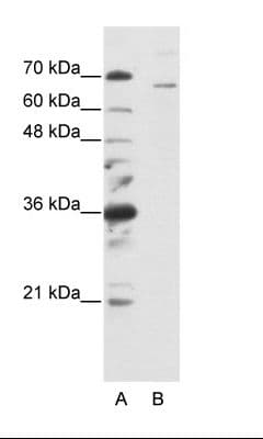 Polyclonal Rabbit anti-Human SF1 Antibody (aa517-566, IHC, WB)