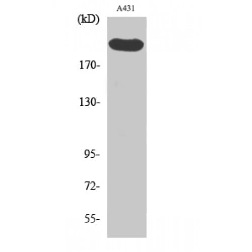 ESPL1 / Separase Antibody (740-820 aa)