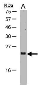 IHC-plus™ ARL2 Antibody
