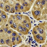 Polyclonal Rabbit anti-Human ACTR2 / ARP2 Antibody (IHC, WB)