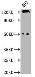 IHC-plus™ Polyclonal Rabbit anti-Human CDH1 / E Cadherin Antibody (IHC, IF, WB)