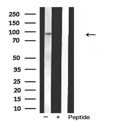 Polyclonal Rabbit anti-Human BSAC / MKL1 Antibody (IF, WB)