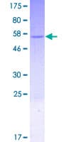 Human GEMIN8 Protein (Recombinant GST)