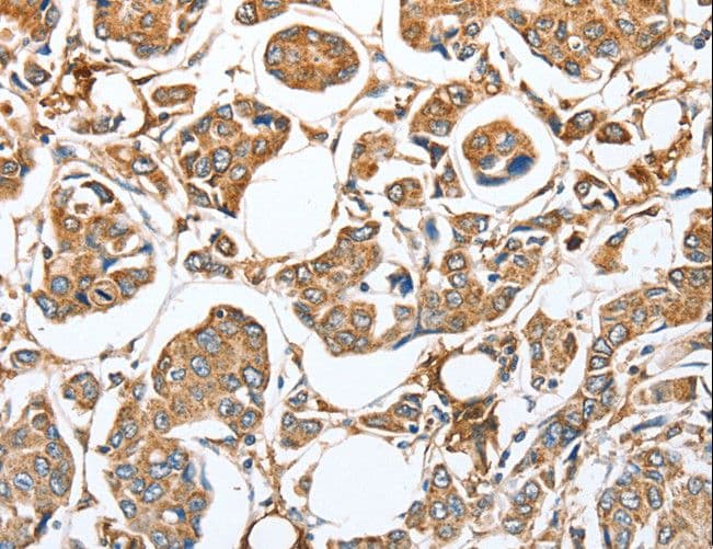 CAPG Antibody