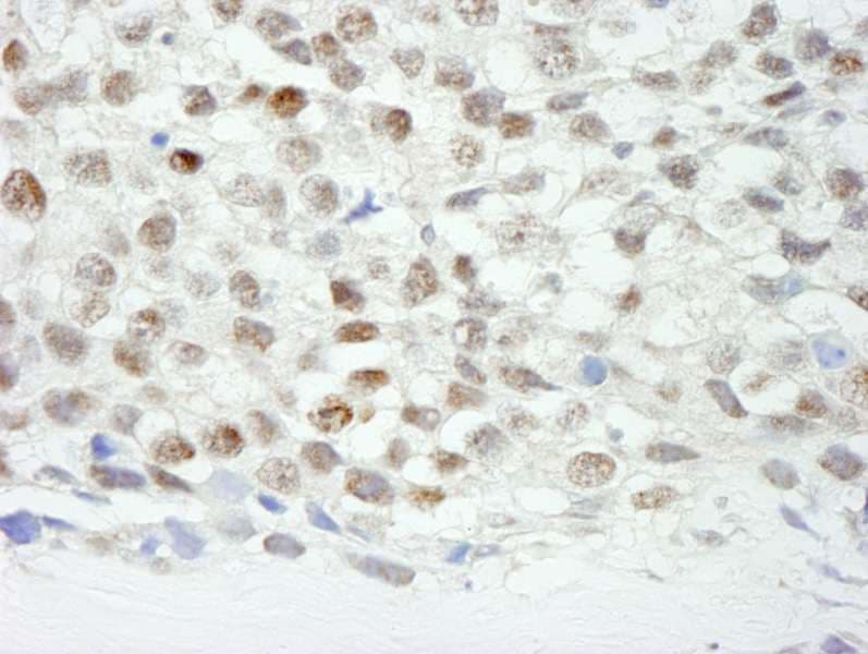 ZNF318 Antibody (aa2049-2099)