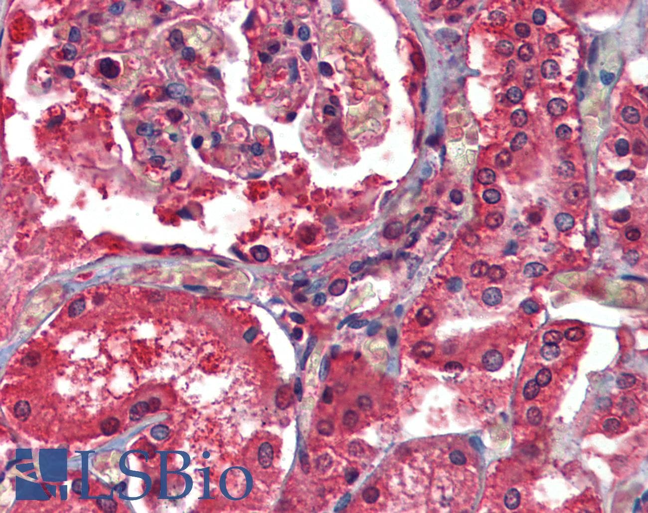 IHC-plus™ STEAP1 / STEAP Antibody (aa130-180)