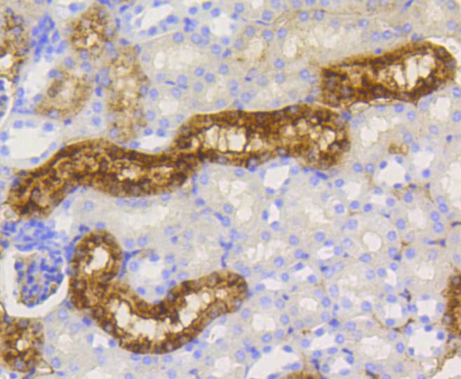 LYZ / Lysozyme Antibody