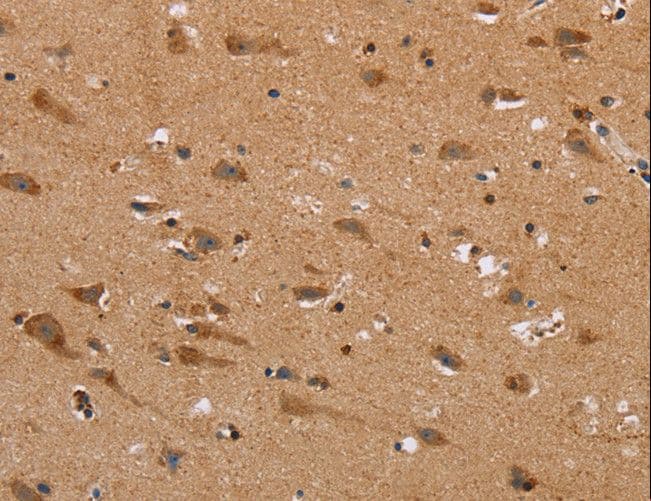 NDRG3 Antibody