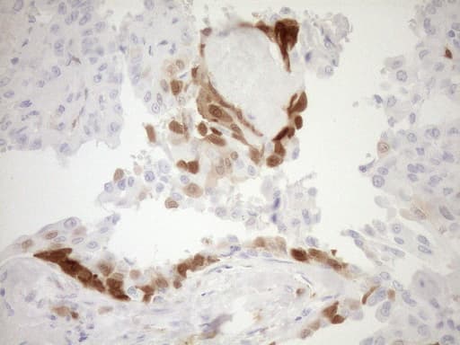 p16INK4a / CDKN2A Antibody (clone OTI3G3)