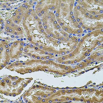 PDCD6IP / ALIX Antibody