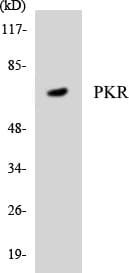 EIF2AK2 / PKR Antibody (aa203-252)