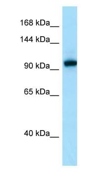 Polyclonal Rabbit anti-Human EPHA7 / EPH Receptor A7 Antibody (aa841-890, WB)