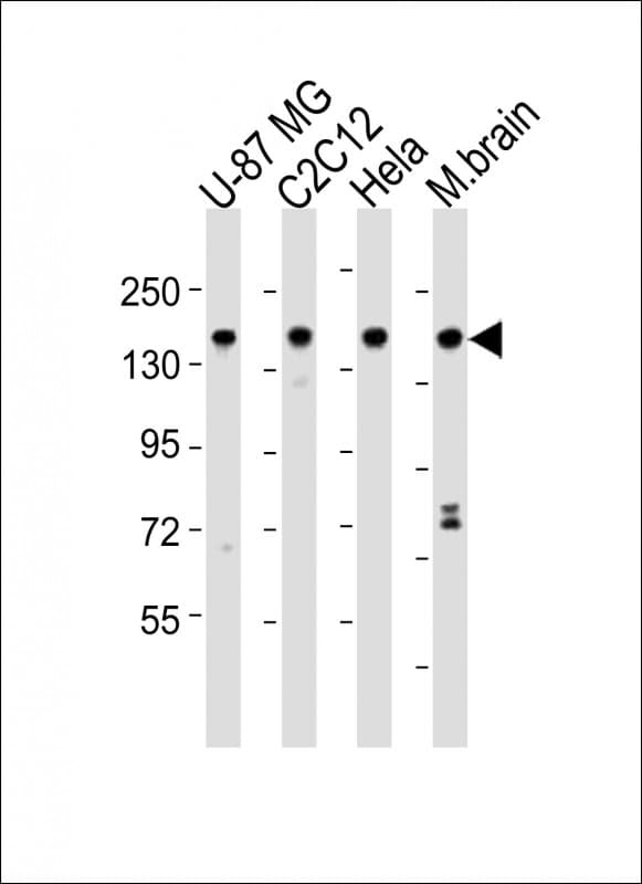 Polyclonal Rabbit anti-Human SMARCC1 / SWI3 Antibody (aa963-997, WB)