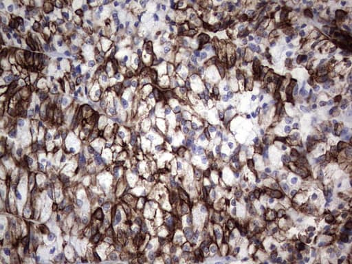IHC-plus™ Acidic Cytokeratin Antibody (clone 1D10)
