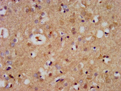CDC42BPB / MRCKB Antibody