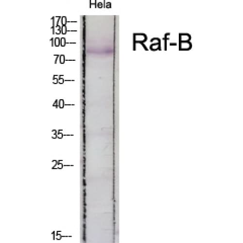 BRAF / B-Raf Antibody (550-630 aa)