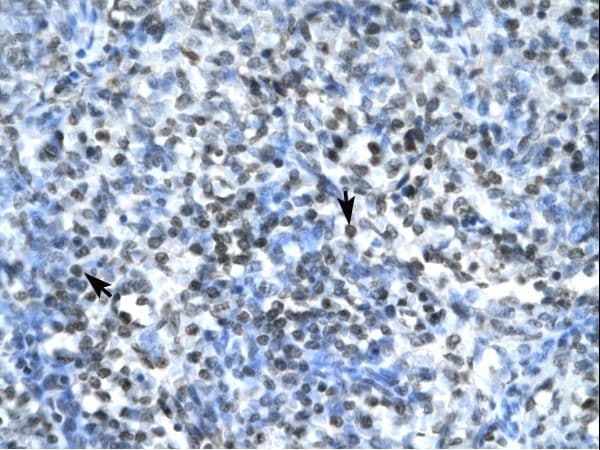 CLDN17 / Claudin 17 Antibody (aa103-152)