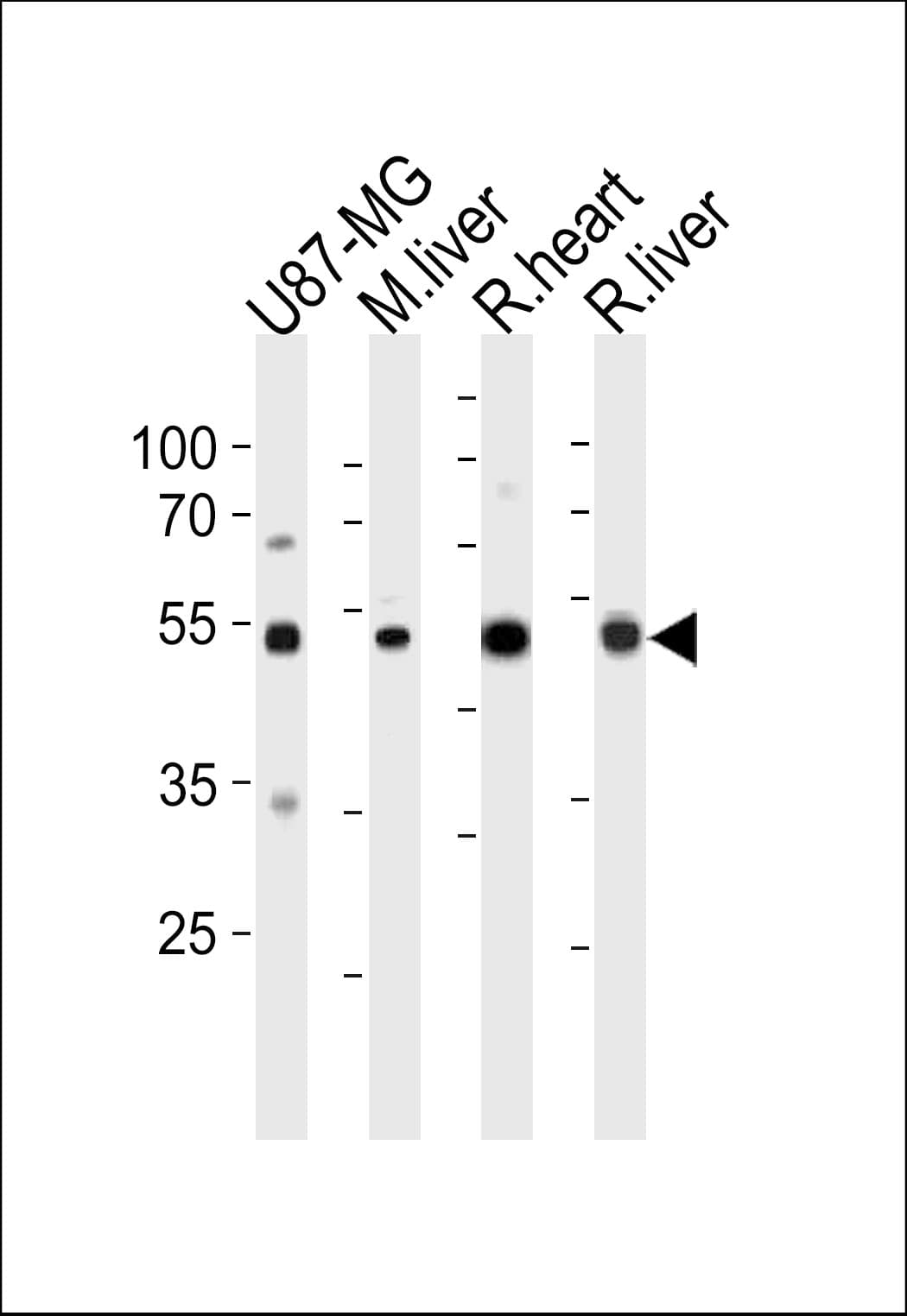 GPT / Alanine Transaminase Antibody (aa118-144)