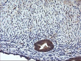 MAP2K1 / MKK1 / MEK1 Antibody (clone OTI2F12)