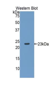 CASP8 / Caspase 8 Antibody (aa217-384)