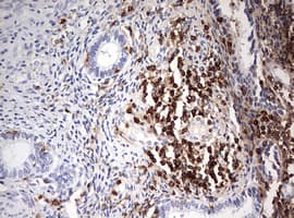 Monoclonal Mouse anti-Human DOCK2 Antibody (clone OTI7G2, aa1544-1830, IHC, WB)