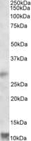IHC-plus™ Polyclonal Goat anti-Human RNF7 Antibody (aa59-71, IHC, WB)