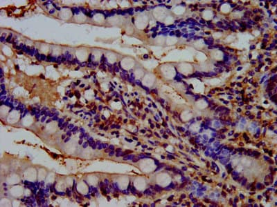 Polyclonal Rabbit anti-Human REPS1 Antibody (IHC, IF)