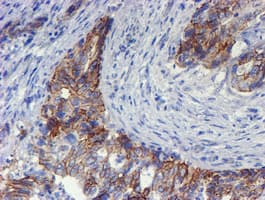 ERBB2 / HER2 Antibody (aa676-1255, clone OTI11A7, Carrier-free)