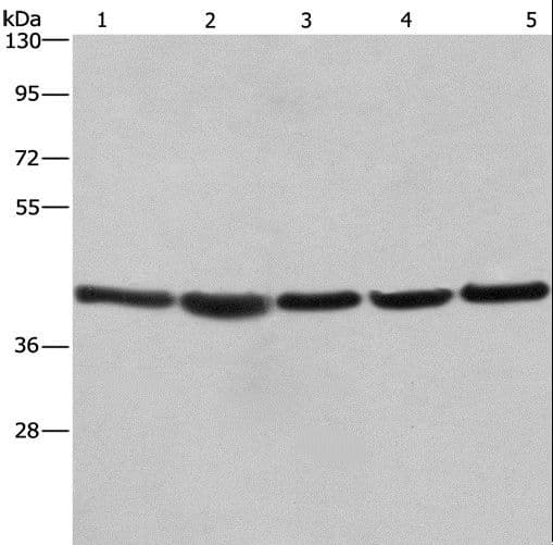 Polyclonal Rabbit anti-Human RPSA / Laminin Receptor Antibody (IHC, WB)