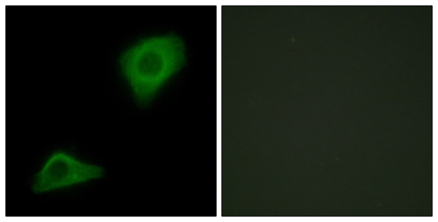 AGPAT9 / MAG1 Antibody
