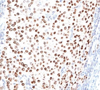 PR / Progesterone Receptor Antibody (clone PR500, Azide-free, BSA-free)