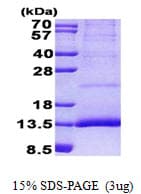 Human CST11 Protein (Recombinant His)