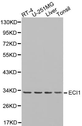 Polyclonal Rabbit anti-Human ECI1 / DCI Antibody (IHC, WB)