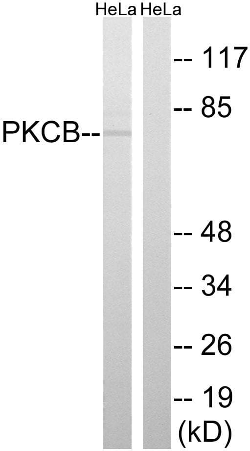 PRKCB / PKC-Beta Antibody (p661)