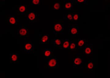 Polyclonal Rabbit anti-Human SAE1 Antibody (IF, WB)