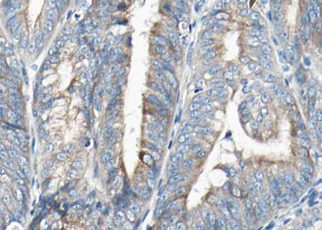 Polyclonal Rabbit anti-Human VEGFB Antibody (IHC, WB)