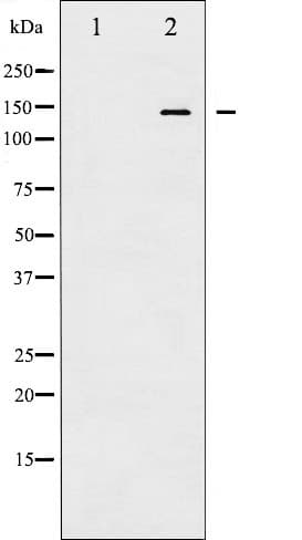 CASR/Calcium Sensing Receptor Antibody (phospho-Thr888)