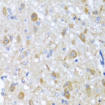 NIX / BNIP3L Antibody