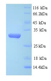 Salmonella typhi aroD Protein (Recombinant His)