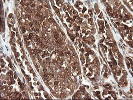 TAPBPL / TAPBPR Antibody (clone OTI4H5)